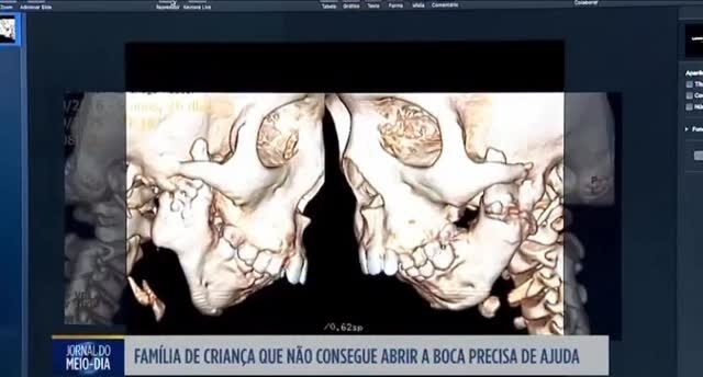 Instagram post from drluisgustavopaiva. This post is in position 1.